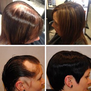 Female hair pieces, bald spot and thinning hair