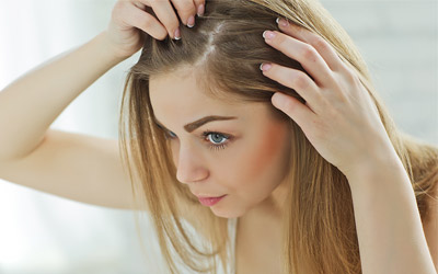 Hair Loss Solution Women
